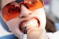 Циркониеви коронки - 34439 разновидности